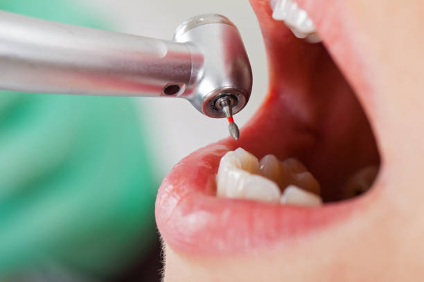 Fast & Reliable Emergency Dental Services in AR